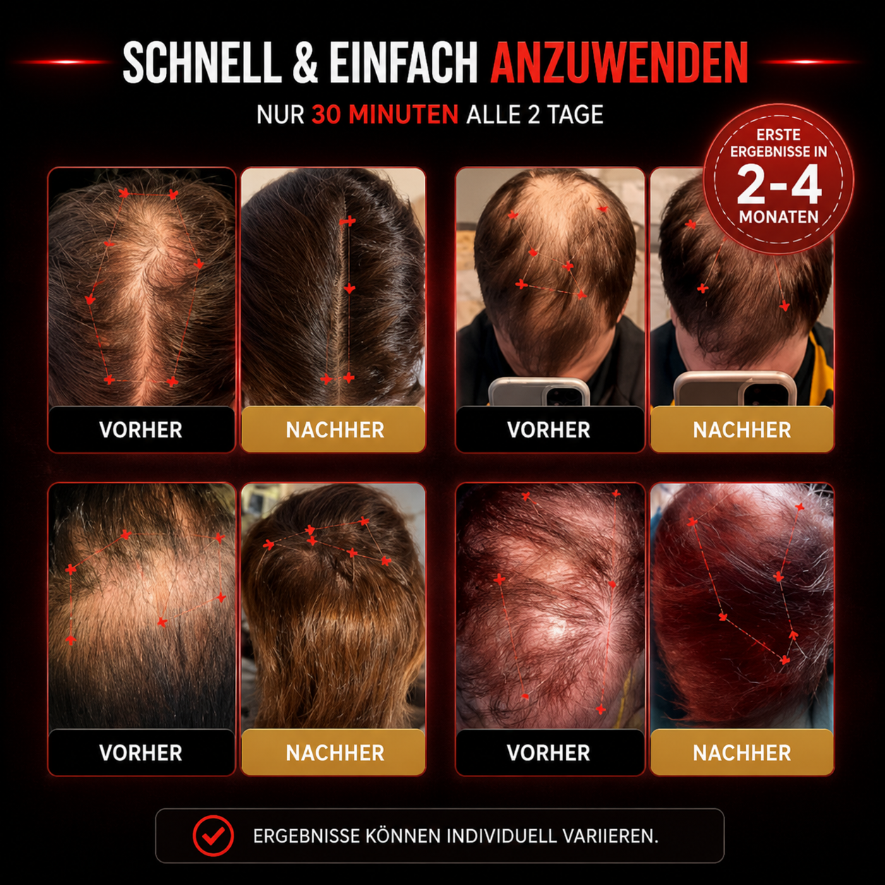 Rotlicht Therapie-Kappe